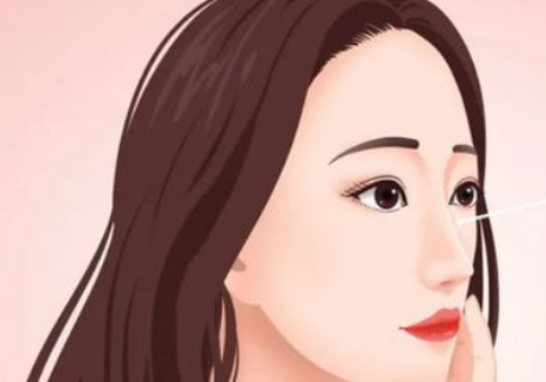 南京鼻基底填充玻尿酸多少錢